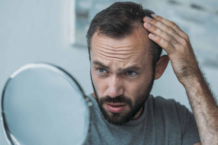 Caduta dei capelli nell'uomo