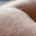 La pelle d'oca è una reazione fisiologica della nostra pelle