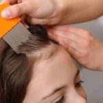 Prevenire eliminare pidocchi: regole comportamento